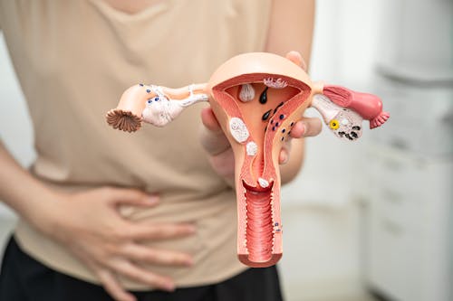 5 cose da sapere sul tumore dell’utero