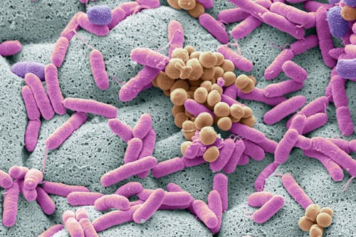 Colpire il tumore al cervello passando dall’intestino