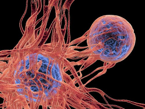 Cancro del seno: individuata una proteina chiave per mantenere la stabilità genetica