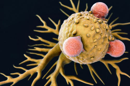 Identikit di IRF4, il gene che aiuta a spegnere la risposta immunitaria contro i tumori