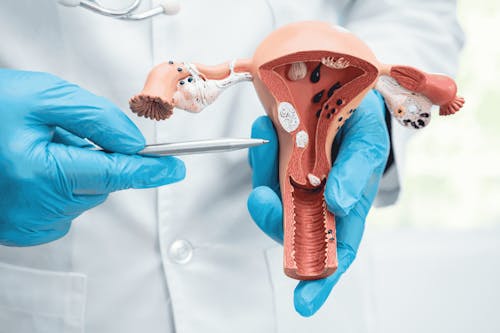 Rimuovere le tube per prevenire il tumore ovarico?