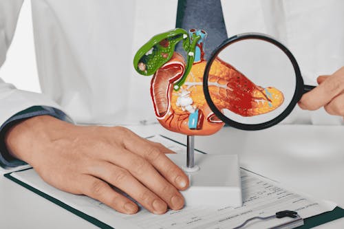Un approccio insolito per la diagnosi del tumore al pancreas