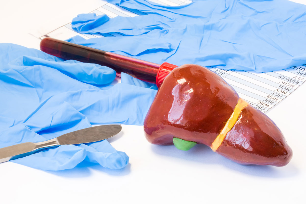 How Painful Is Liver Surgery When Doctor Removed Liver During Surgery