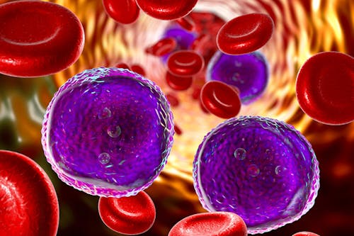 Leucemia linfoblastica acuta di tipo T: il paradosso delle cellule soppressorie