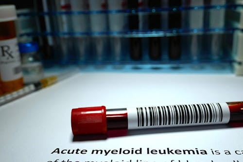 Leucemia mieloide acuta: il lato oscuro dell’interferone