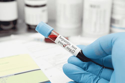 Virus e cancro: la IARC riconosce nuovi agenti infettivi come cancerogeni